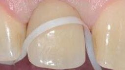 Endodontosaurus - izumiruća vrsta?