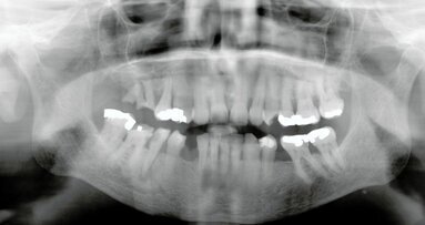 Met QuickSleeper bleef patiënt rustig
