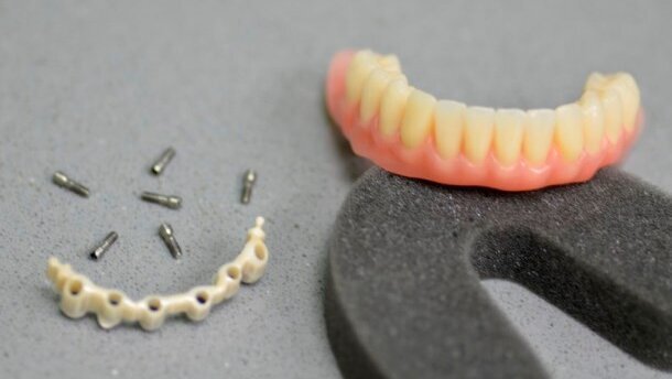 Rehabilitacja bezzębnej żuchwy w trudnych warunkach anatomicznych – opis przypadku