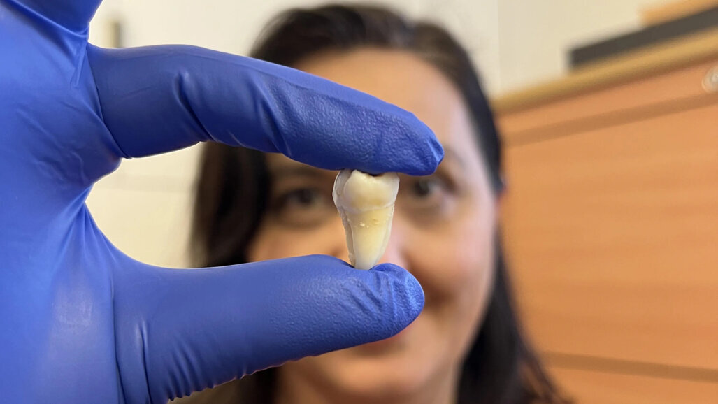 新研究在实验室培育牙齿方面取得了进展