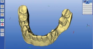 Ewolucja rozwiązań CAD/CAM