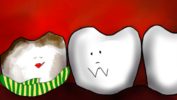 Filmwettbewerb „Zähne gut – alles gut“: Gewinner stehen fest