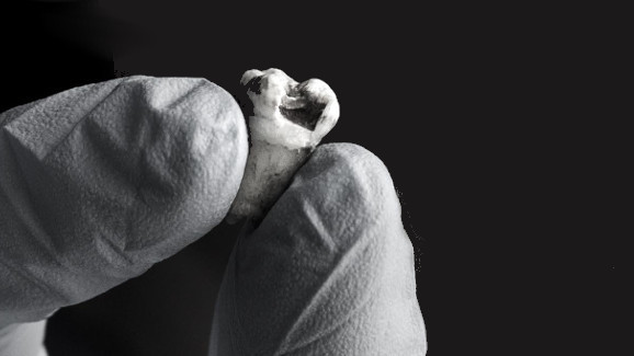 Laboratorio degli Stati Uniti sequenzia il DNA da un dente di John Lennon