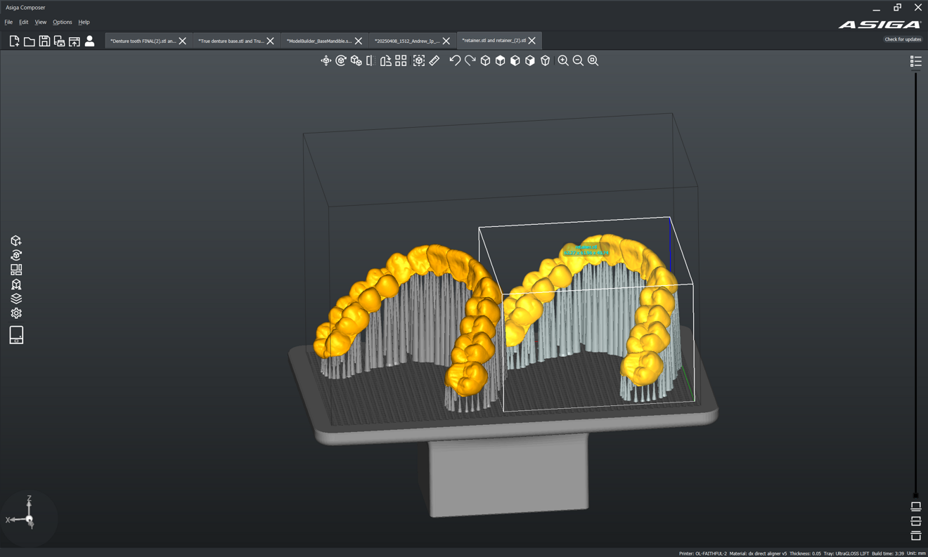 Fig. 4b: Support placement along the retainer borders in Composer.