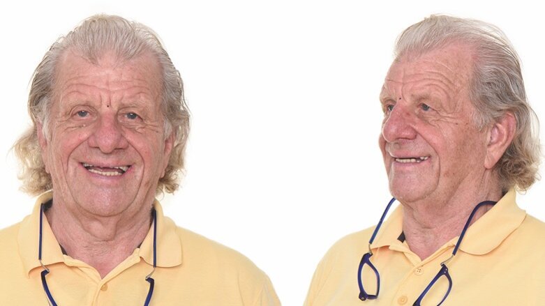 Un nuevo enfoque para el tratamiento de edéntulos