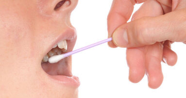 Analiza sline mogla bi otkriti vještine donošenja odluka