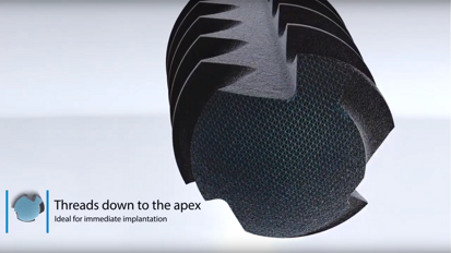 camlog PROGRESSIVE-LINE Animation