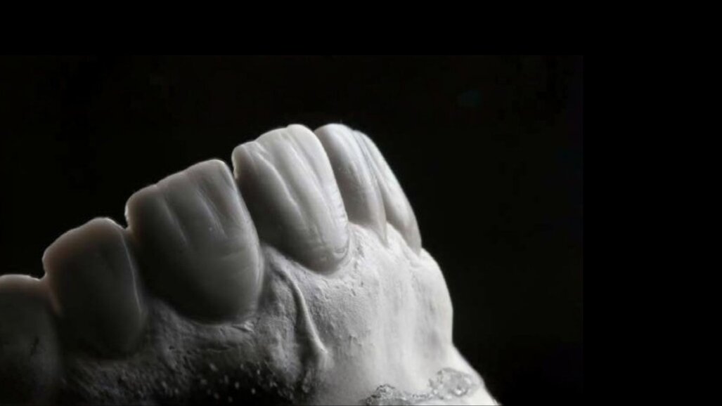 Redefining smile harmony: The concept of Hood Proportion for the  Malaysian population