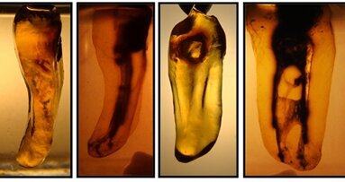 Dents transparentes : un puissant outil didactique