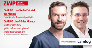 2 CME-Punkte: CAMLOG Live-Studio-Tutorial & Live-OP im Archiv