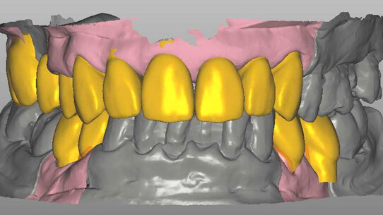 Odontoiatria estetica: il paziente protagonista della sinergia tra odontoiatra e odontotecnico