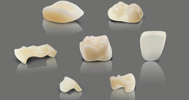 Interview: Fast, affordable and aesthetic 3D-printed dental restorations