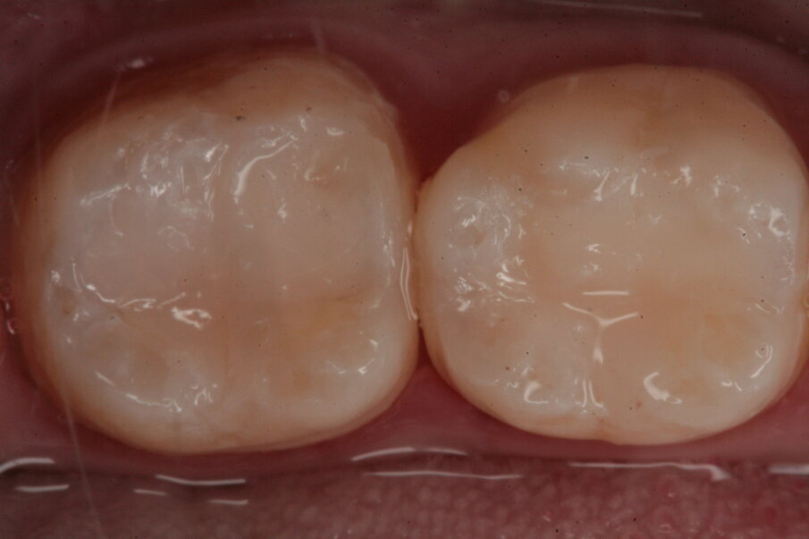 Fig. 22_Visione finale del restauro.