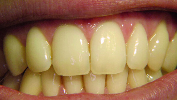 Ce que nos dents disent de nous — Partie I