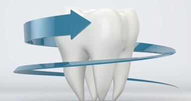 Nieuw kunstmatig glazuur harder en duurzamer dan echt tandglazuur
