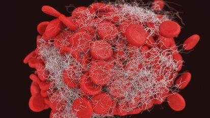 Concentrati piastrinici: Ingegneria tissutale o medicina rigenerativa?