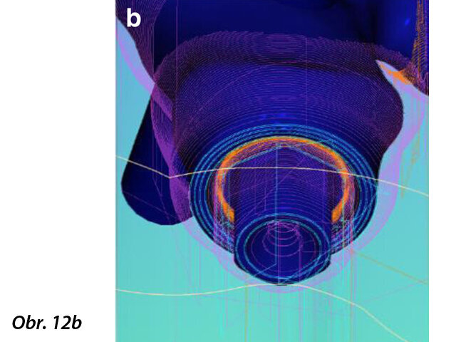 Okluzální pohled na CAD návrh definitivní fixní náhrady (a) a detailní snímek tvaru abutmentu (b).