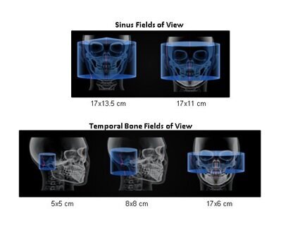 Ryc. 1_ Okna obrazowania w tomografii stożkowej o zmiennym polu obrazowania.
