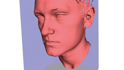 Cefalometria Radiation Free possibile e auspicabile alternativa diagnostica?