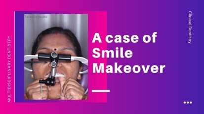A minimally invasive smile makeover: an orthodontic-restorative approach.