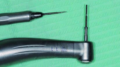 L’implant plutôt que le « dentier » : une réalité incontournable, mais une préparation et des précautions indispensables