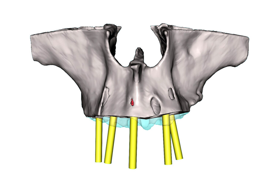 Fig. 8b