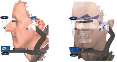 Utilizzo clinico della scansione facciale in ambito odontoiatrico