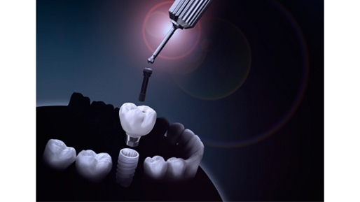 Nobel Biocare – NobelProcera restorations