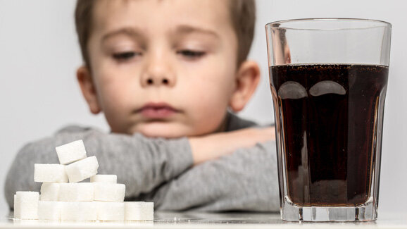 England: Bei 128.000 Kindern müssen Zähne entfernt werden