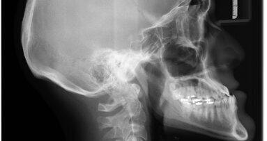 Obrazowanie 2D w stomatologii – kurs dla lekarzy dentystów