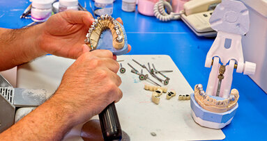 Profilo dell’odontotecnico: il Presidente Prada ribadisce il suo parere, non serve un nuova figura sanitaria