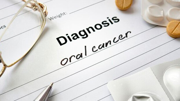 Grazie alla visualizzazione a fluorescenza la recidiva del cancro orale potrebbe diminuire