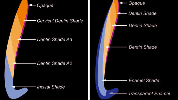 Shading technique in direct aesthetic restorations