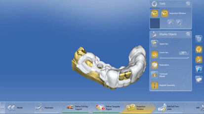 Proteticky řízené umístění implantátu a náhrady: Rychlý a elegantní pracovní postup Dentsply Sirona