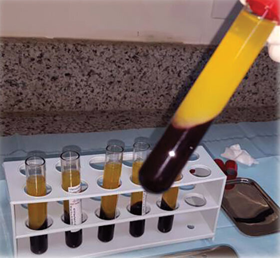 Fig. 2: Doctor usually expends less than two minutes drawing patient’s blood.