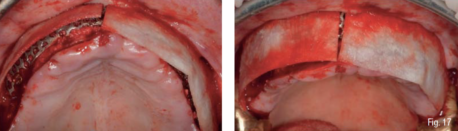 Fig. 17