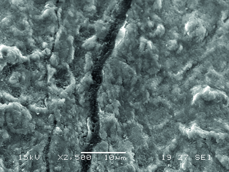 Fig. 2b: Scanning electron microscope (SEM) images of sealed and protected dentine surfaces after treatment with nHAp agent by PrevDent.