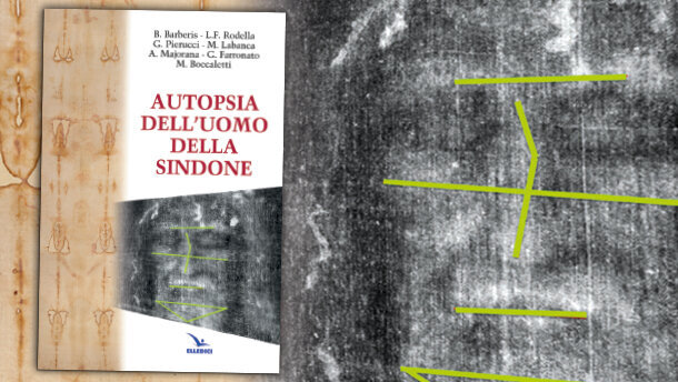 In occasione dell'Ostensione della Sindone, una Autopsia dell’Uomo della Sindone, fatta da 5 medici (tre odontostomatologi)