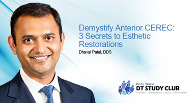 Уебинар: Разкрийте тайните на естетичните възстановявания на фронталните зъби със CEREC