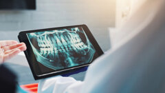 Pearl AI reveals hidden oral health crisis