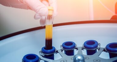 Emocomponenti a uso non trasfusionale (EunT): vantaggi e criticità