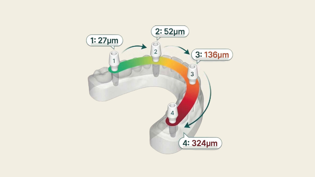 Fig. 1 - Propagazione dell’errore di stitching lungo un’arcata completa. La deviazione aumenta con la distanza dal punto di partenza della scansione.