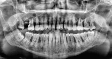 Do our patients know the value of a tooth?