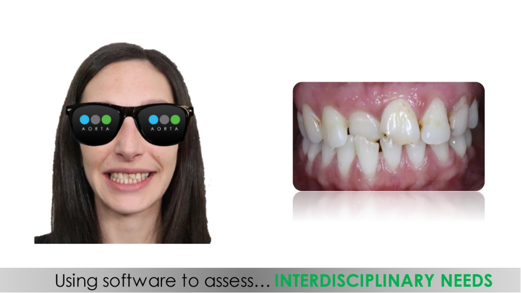 Fig. 32: Patient’s facial photograph to be considered in the treatment plan, alongside a close-up view of the patient’s smile.