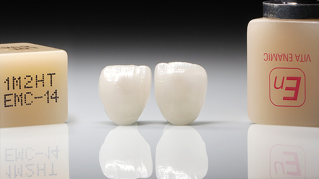 Fig. 12. Las carillas ya acabadas, poco antes de la prueba clínica en boca.