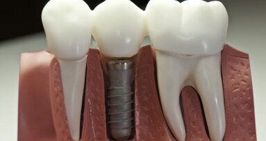 Gel stimuleert botgroei rond implantaat