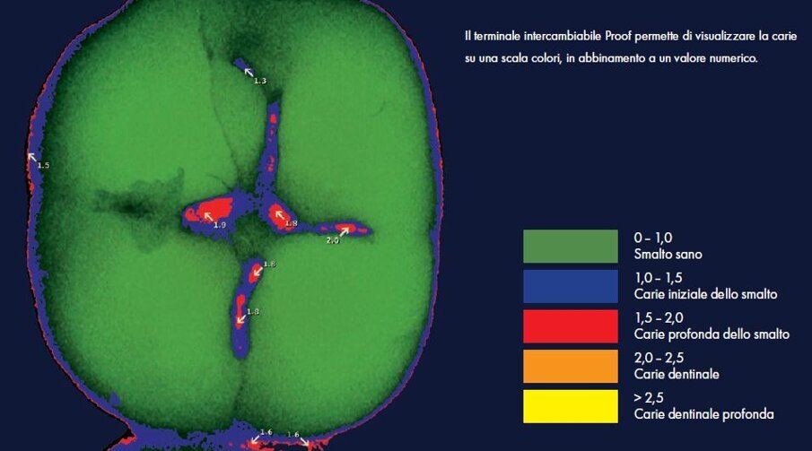 3-terminale interc Proof