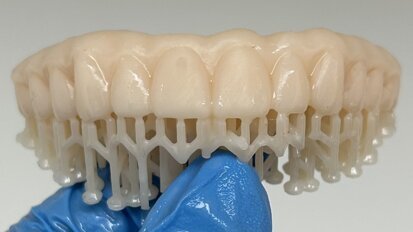 The use of inexpensive 3D printers to provide in-office solutions for immediate temporary restorations on implants