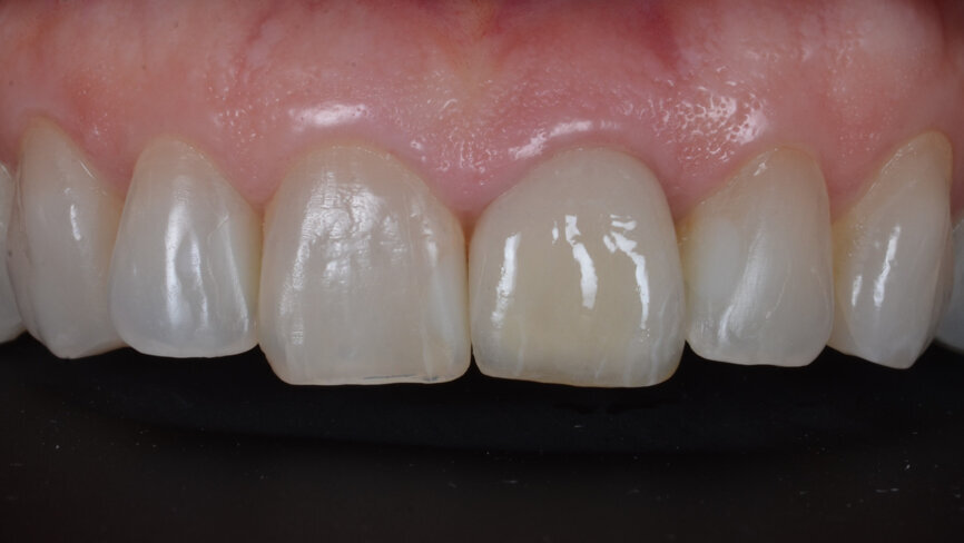 Fig. 32: Final result close up.