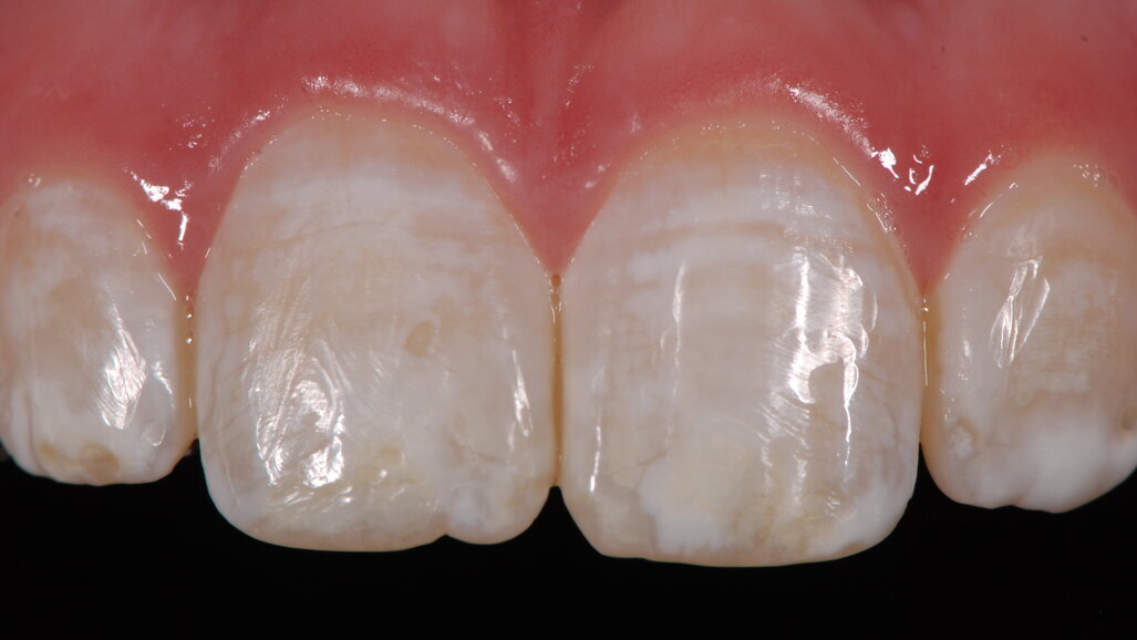 La importancia del pH en los agentes aclaradores